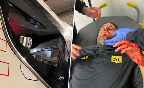 Варварское нападение в Марселе. Тренеры «Лиона» получили серьёзные травмы